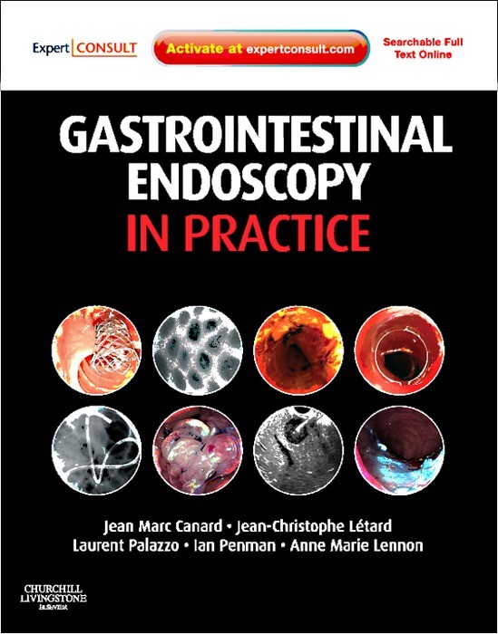 Gastrointestinal Endoscopy In Practice - E-Book - Frohberg