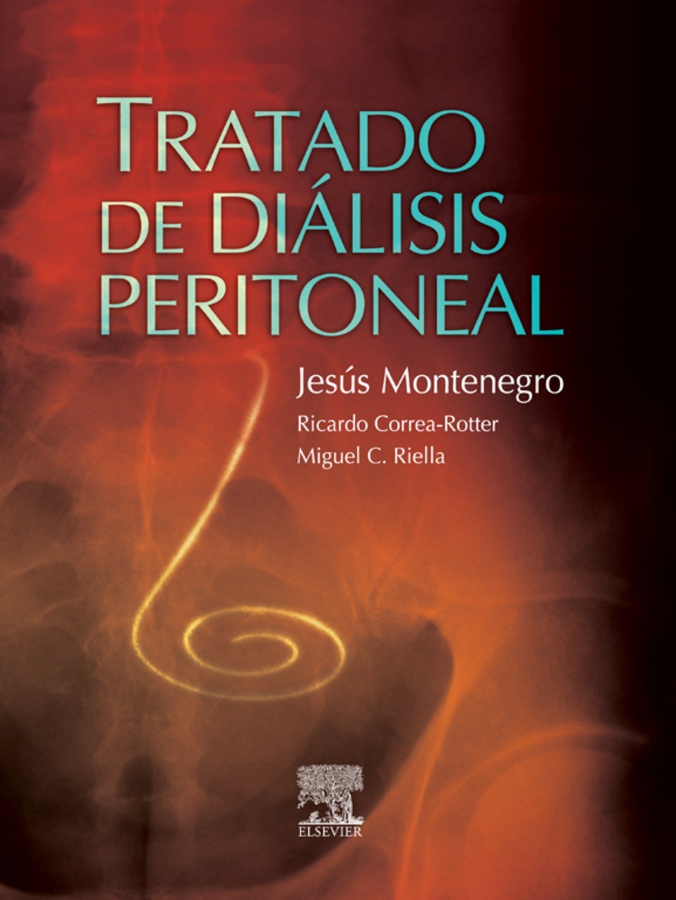 Cover Diálisis peritoneal