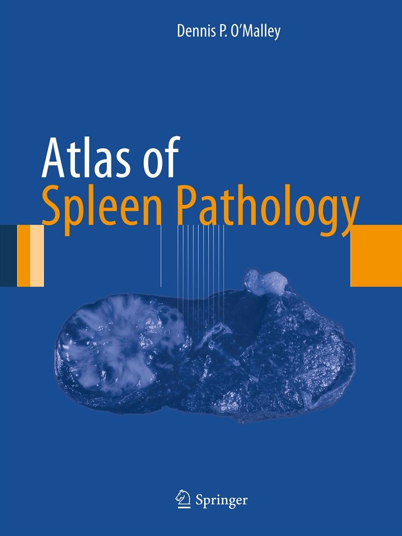 Atlas of Spleen Pathology
