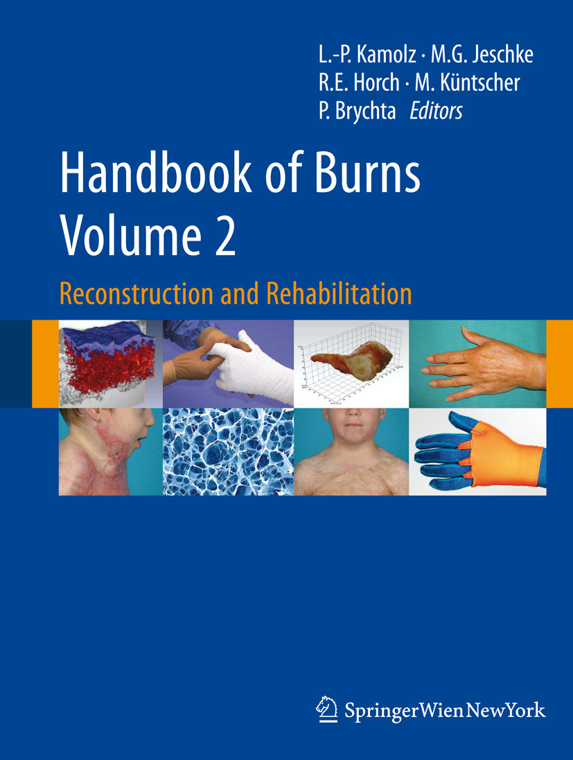 Handbook of Burns Volume 2