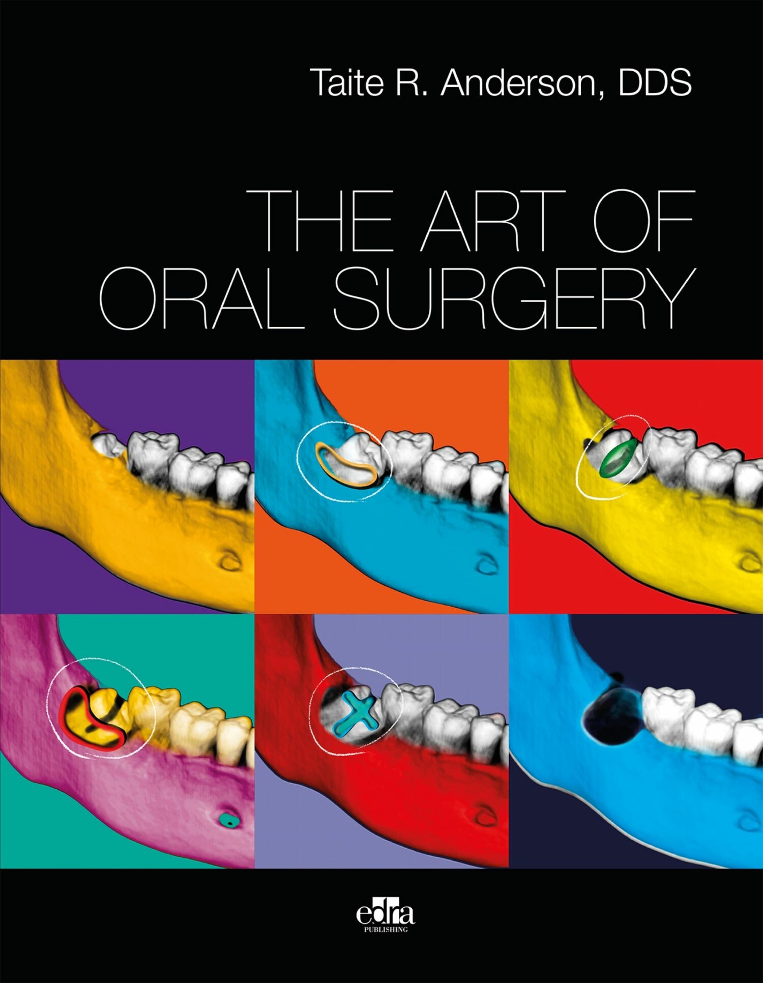 THE ART OF ORAL SURGERY