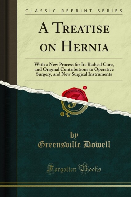 Treatise on Hernia