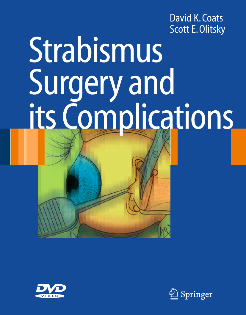 Cover Strabismus Surgery and its Complications