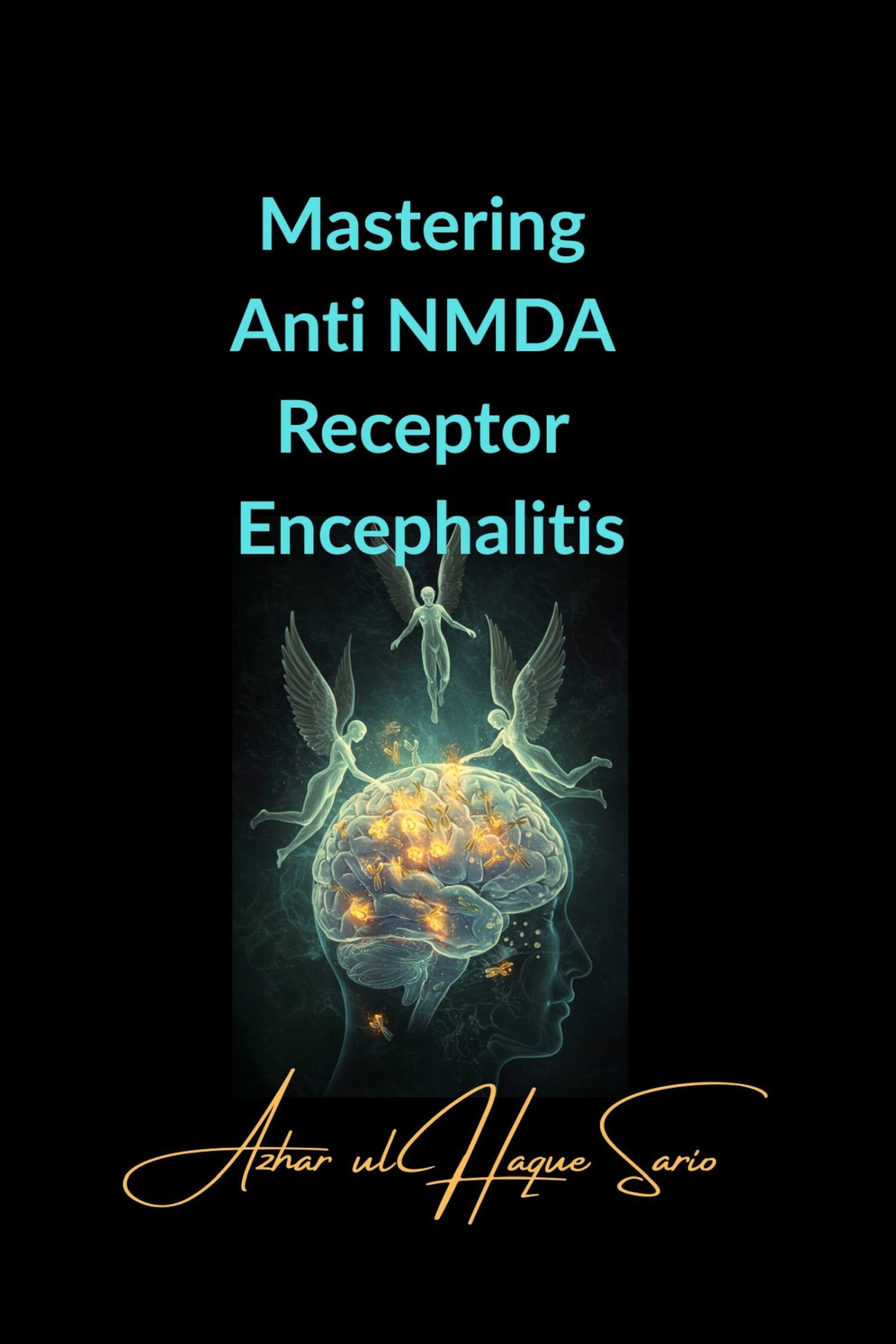 Mastering Anti NMDA Receptor Encephalitis