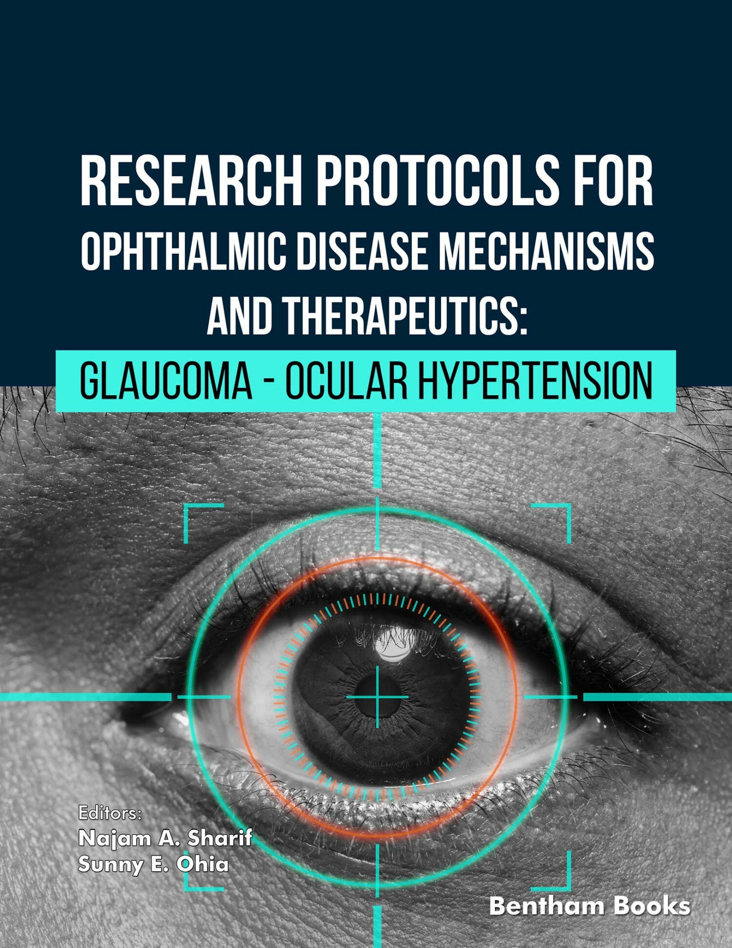 Cover Research Protocols for Ophthalmic Disease Mechanisms and Therapeutics: Glaucoma - Ocular Hypertension