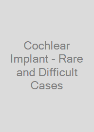 Cochlear Implant - Rare and Difficult Cases