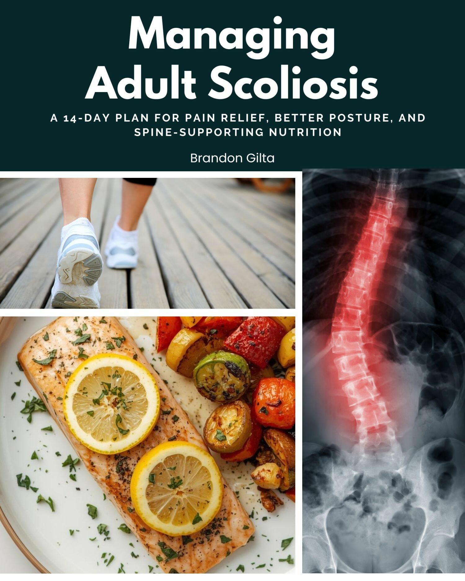Managing Adult Scoliosis