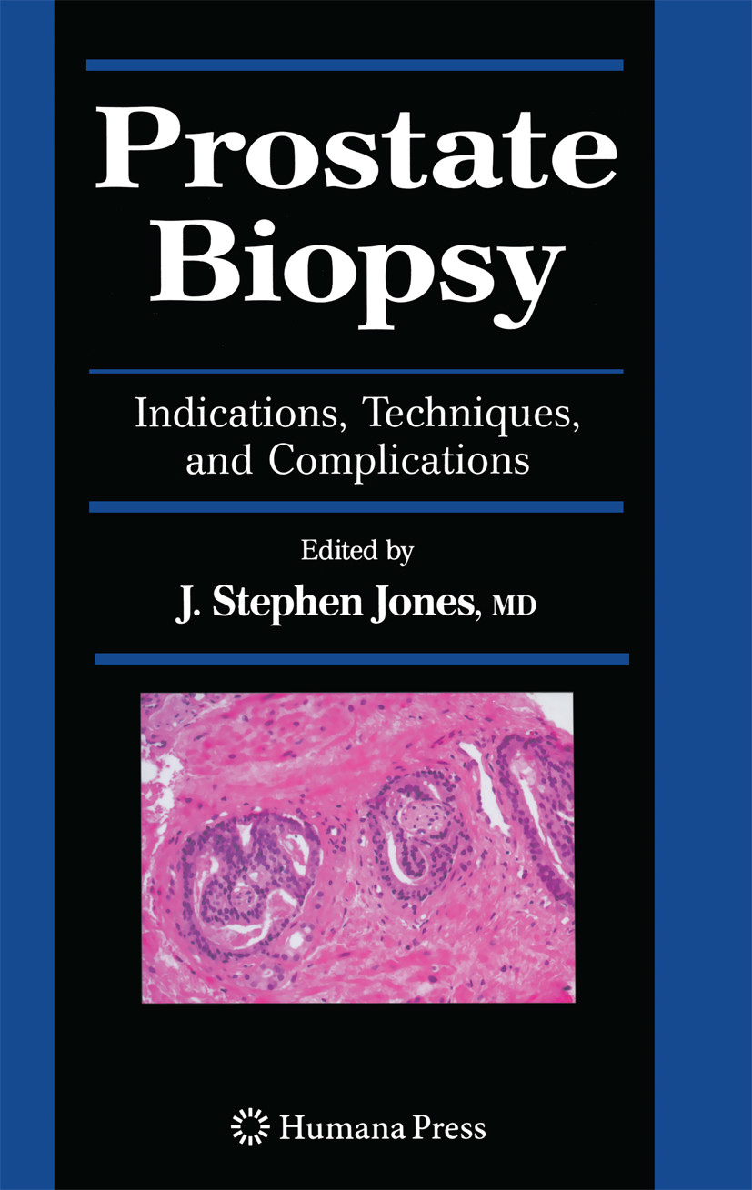 Cover Prostate Biopsy