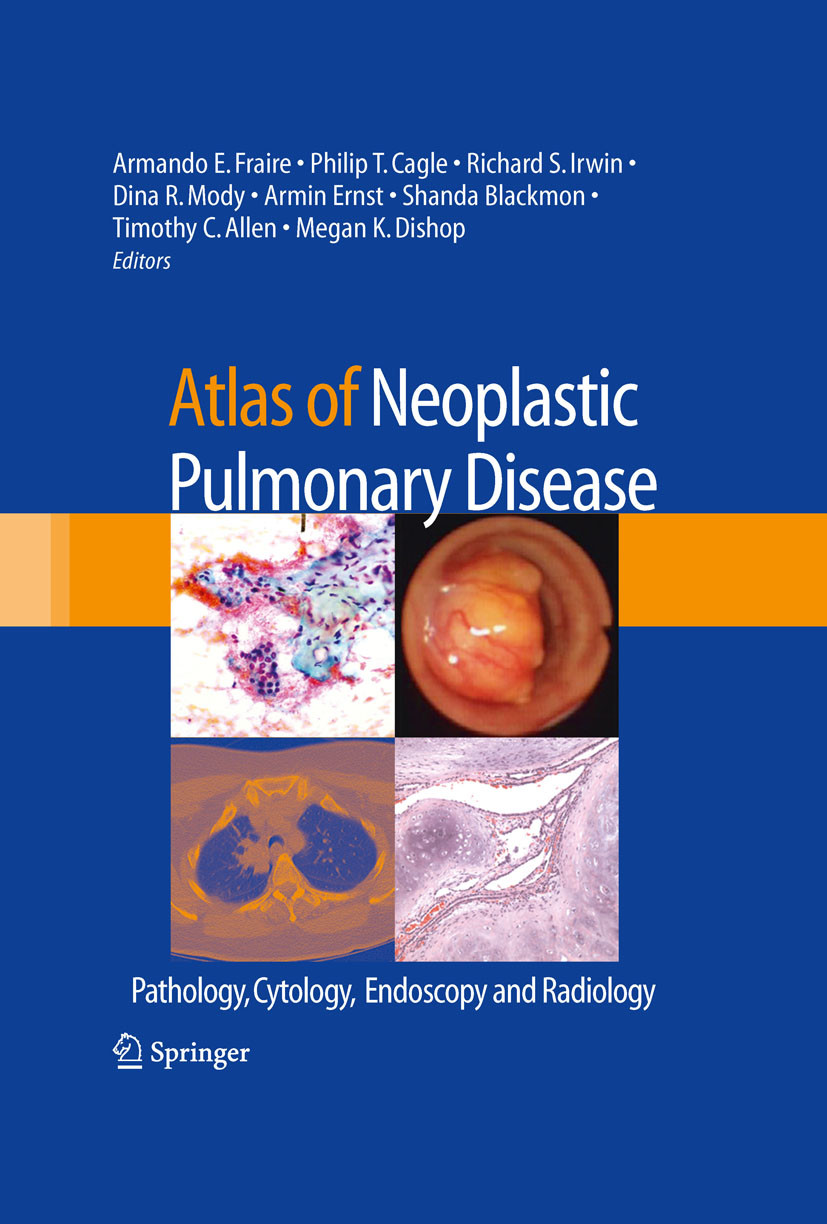 Cover Atlas of Neoplastic Pulmonary Disease