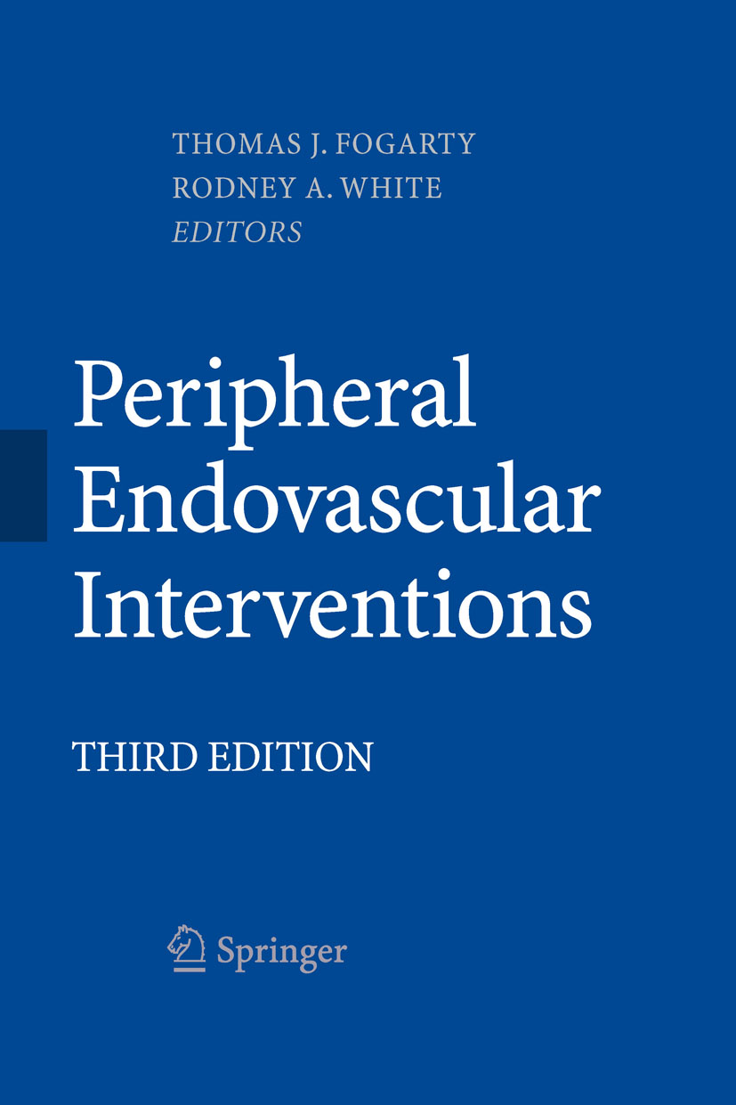 Peripheral Endovascular Interventions - E-Book - Frohberg