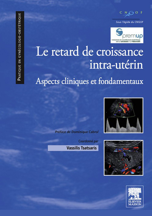 Cover Le retard de croissance intra-utérin