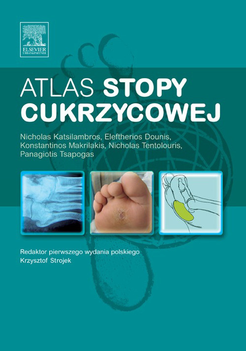 Cover Atlas stopy cukrzycowej