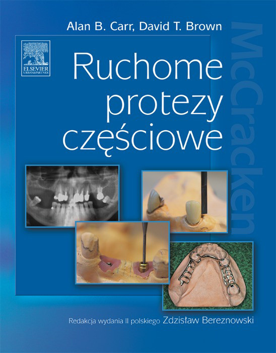 Cover Ruchome protezy czesciowe