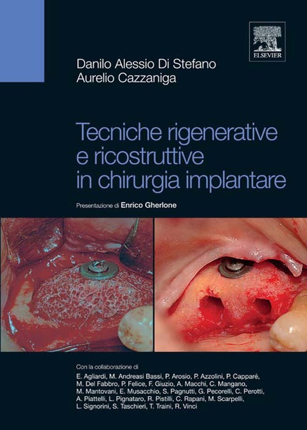 Cover Tecniche rigenerative e ricostruttive in chirurgia implantare
