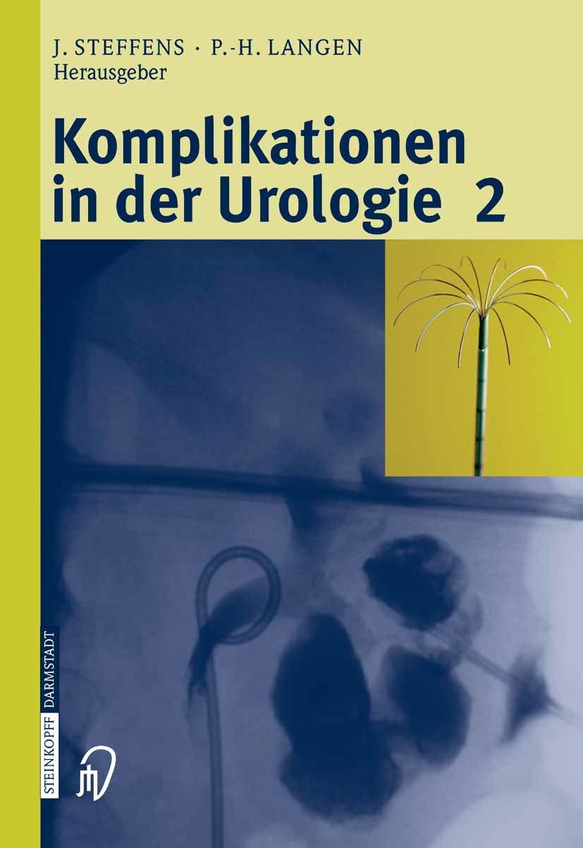 Cover Komplikationen in der Urologie 2