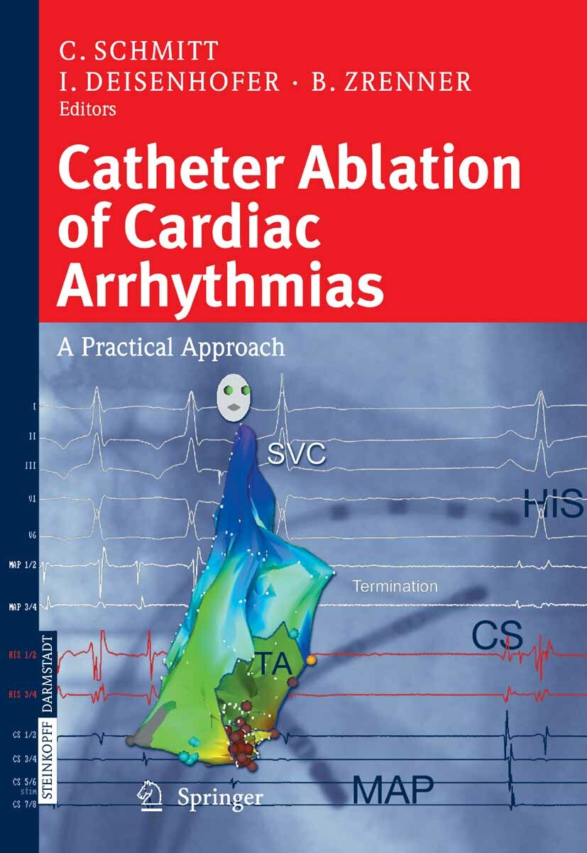 Cover Catheter Ablation of Cardiac Arrhythmias