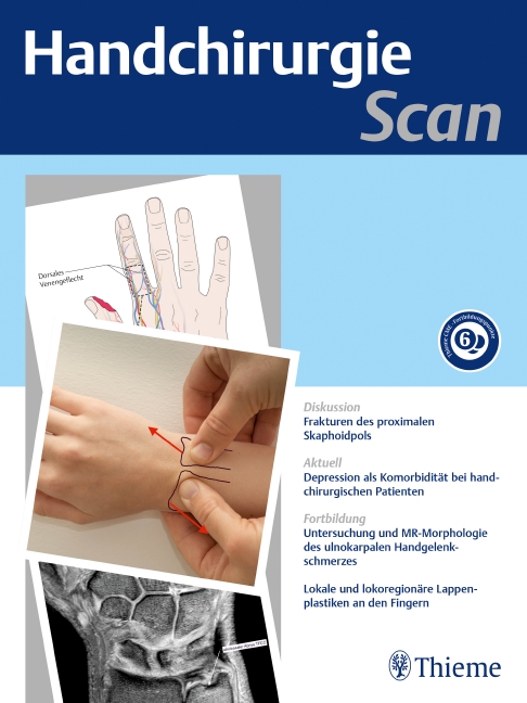 Handchirurgie Scan