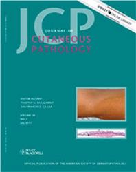 Cover Journal of Cutaneous Pathology