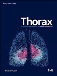 Cover Thorax