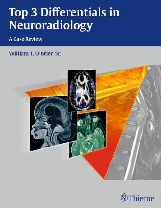 Top 3 Differentials in Neuroradiology