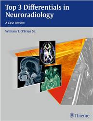 Cover Top 3 Differentials in Neuroradiology