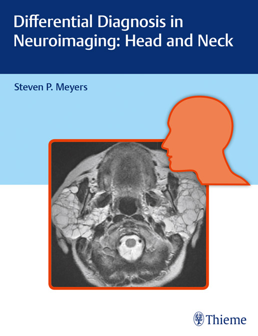 Differential Diagnosis in Neuroimaging: Head and Neck