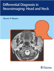 Cover Differential Diagnosis in Neuroimaging: Head and Neck