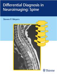 Cover Differential Diagnosis in Neuroimaging: Spine