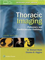 Cover Thoracic Imaging - Pulmonary and Cardiovascular Radiology