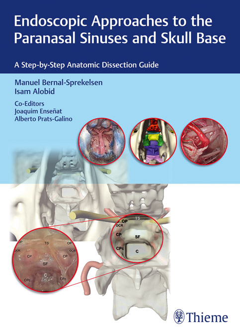 Endoscopic Approaches to the Paranasal Sinuses and Skull Base