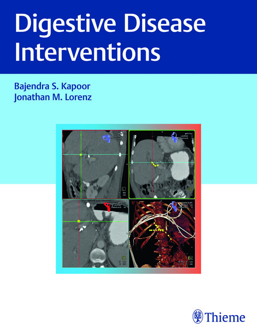 Digestive Disease Interventions