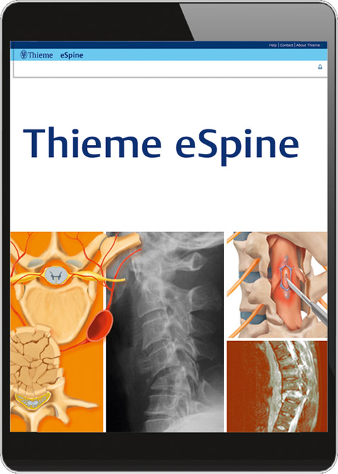 Thieme eSpine (Online-Datenbank)