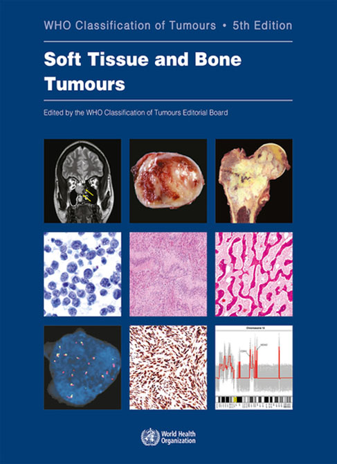 WHO Classification of Tumours. Soft Tissue and Bone Tumours