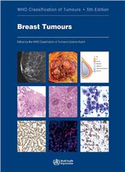 Cover WHO Classification of Tumours: Breast Tumours