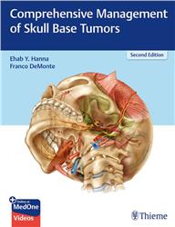 Cover Comprehensive Management of Skull Base Tumors