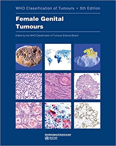 WHO Classification of Tumours. Female Genital Tumours