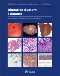 Cover WHO Classification of Tumours: Digestive System Tumours