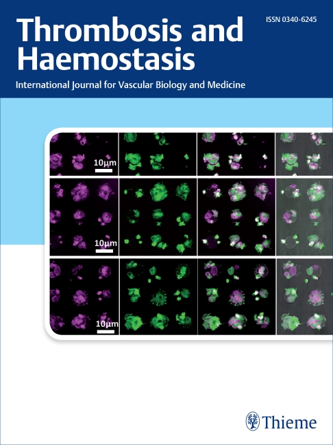 Thrombosis and Haemostasis