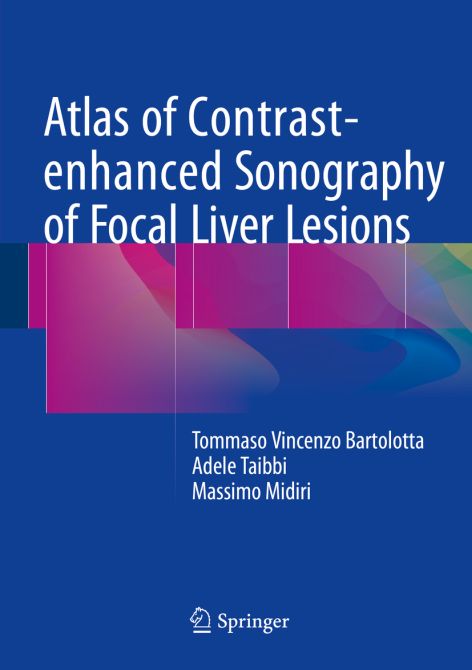 Atlas of Contrast-enhanced Sonography of Focal Liver Lesions