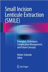 Cover Small Incision Lenticule Extraction (SMILE)