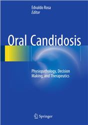 Cover Oral Candidosis