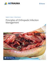 Cover Principles of Orthopedic Infection Management