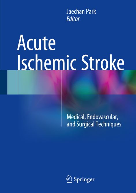 Acute Ischemic Stroke