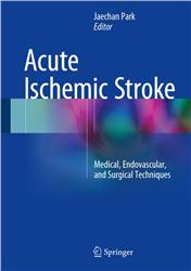 Cover Acute Ischemic Stroke