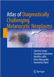 Cover Atlas of Diagnostically Challenging Melanocytic Neoplasms