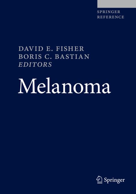 Melanoma