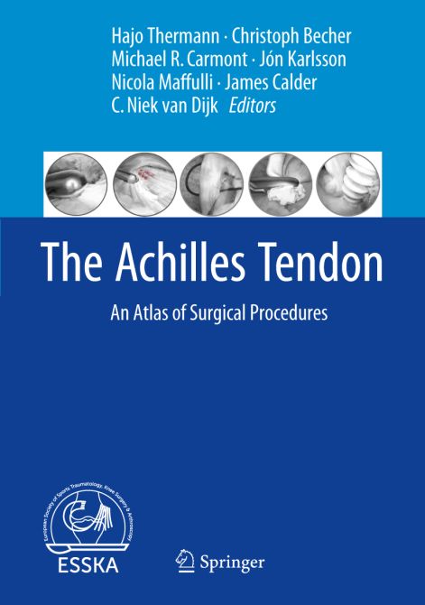 The Achilles Tendon