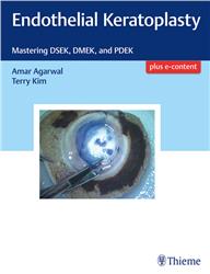 Cover Endothelial Keratoplasty