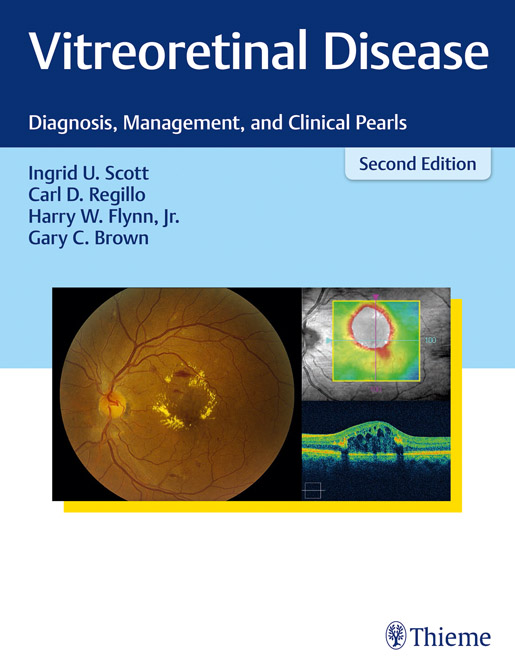 Vitreoretinal Disease