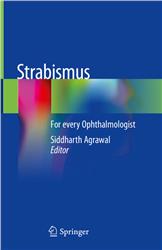 Cover Strabismus for every Ophthalmologist